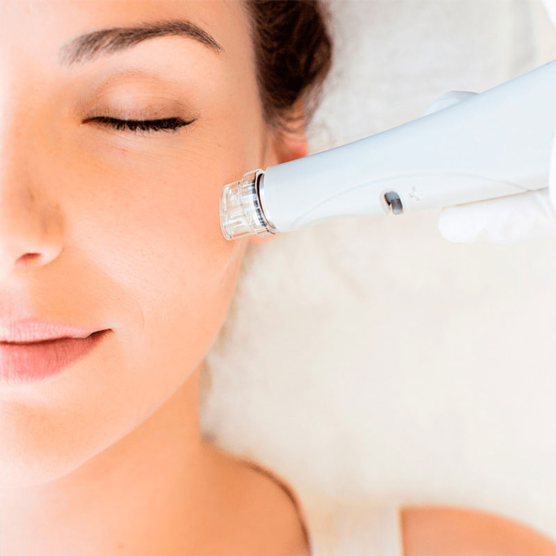 Hydrafacial